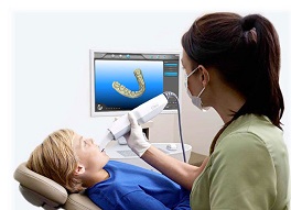 Scanner intraorale per impronte digitali