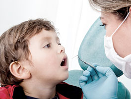 Cura dei denti con il laser per bambini